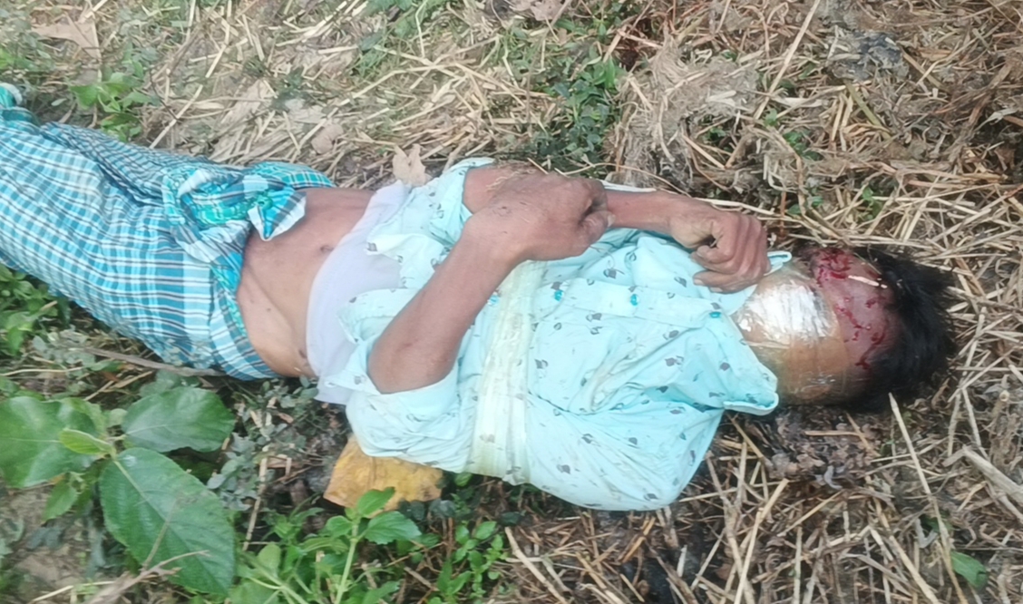সোনারগাঁওয়ে অটোচালক প্রতিবন্ধী যুবককে শ্বাসরোধে হত্যা, অটো ছিনতাই।
