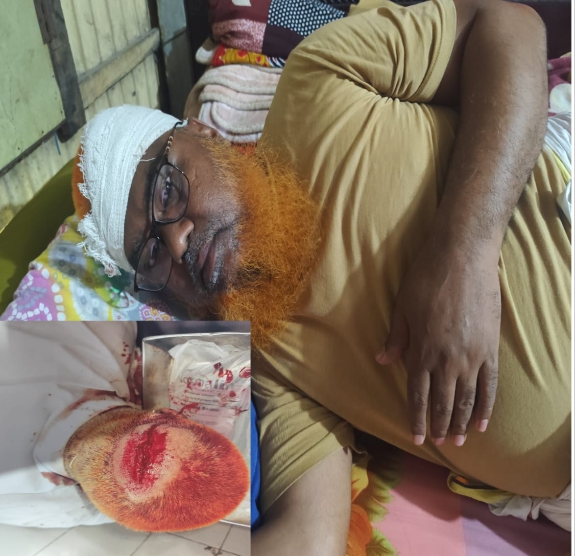 বন্দরে চাঁদা না পেয়ে ব্যবসায়ীকে কুপিয়ে মারাত্মক জখম সহ বাড়িঘর লুট-থানায় অভিযোগ।